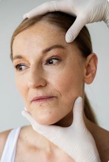 Age Spots Treatment